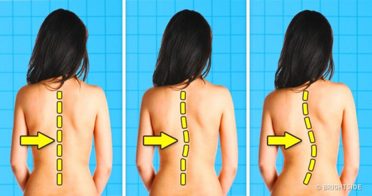 8 καθημερινές δραστηριότητες που μπορούν να καταστρέψουν την σπονδυλική στήλη