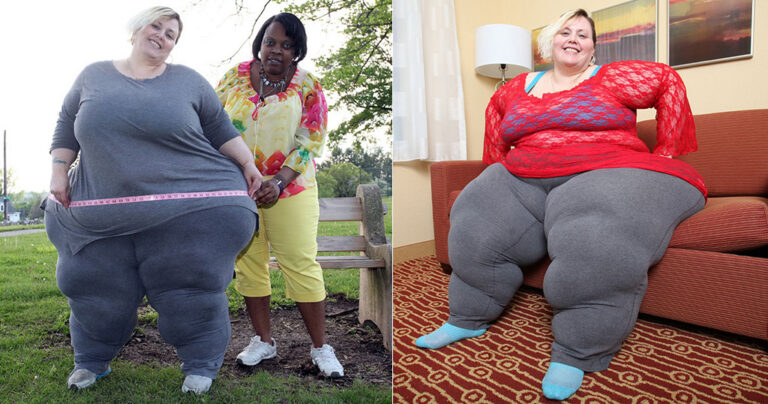 43χρονη θέλει να αποκτήσει τους μεγαλύτερους γοφούς στον κόσμο ακόμα και αν πεθάνει