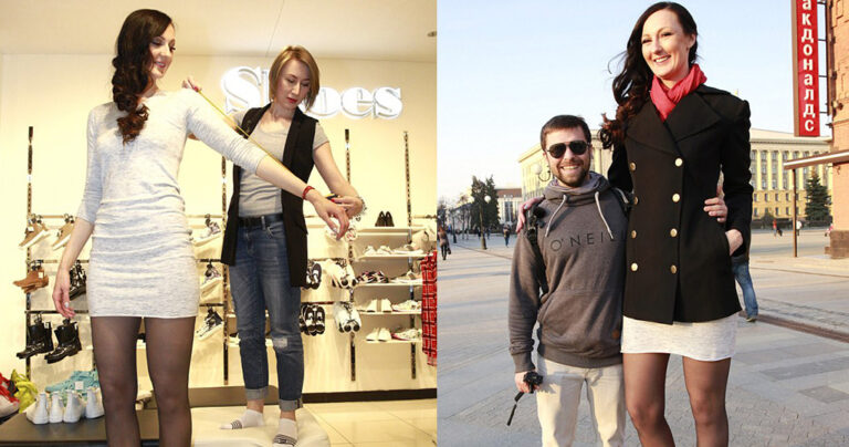 29χρονη δίμετρη Ρωσίδα ισχυρίζεται ότι έχει τα ψηλότερα πόδια στον κόσμο