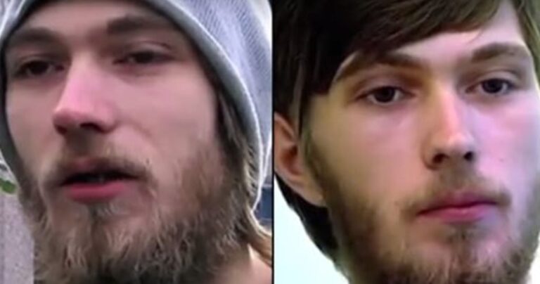 Άντρας δείχνει τα δόντια του που έχει να τα πλύνει 20 χρόνια