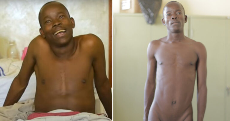 21χρονος με τους μεγαλύτερους όρχεις του κόσμου αναγκάστηκε να παρατήσει τις σπουδές