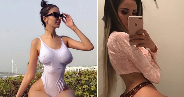 24χρονο μοντέλο ξόδεψε σχεδόν 500.000 ευρώ για να βάλει 4 λίτρα λίπους στα οπίσθια της