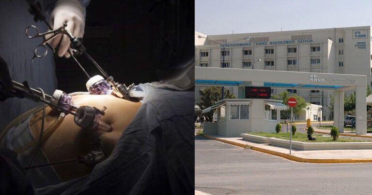 Παγκοσμίως σπάνια χειρουργική επέμβαση στο Νοσοκομείο Πάτρων σε ασθενή άνω των 350 κιλών