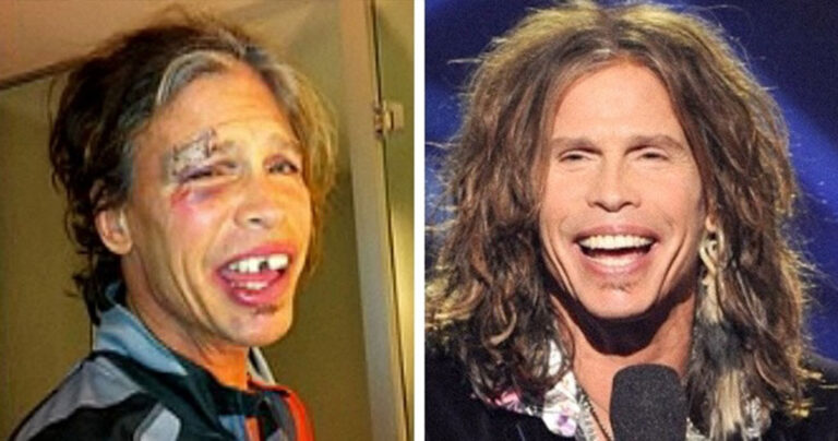 14 διάσημοι που ήταν κάποτε εξαρτημένοι αλλά πάλεψαν και βγήκαν νικητές