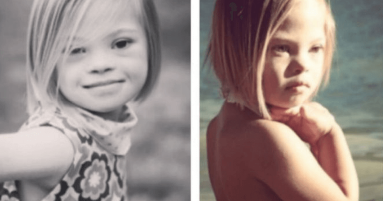 Η πιτσιρίκα που αποδεικνύει ότι το σύνδρομο Down δεν είναι τρομακτικό