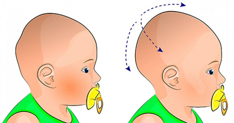 7 προφανείς λόγοι ότι το παιδί σας πρέπει να δει επειγόντως έναν γιατρό