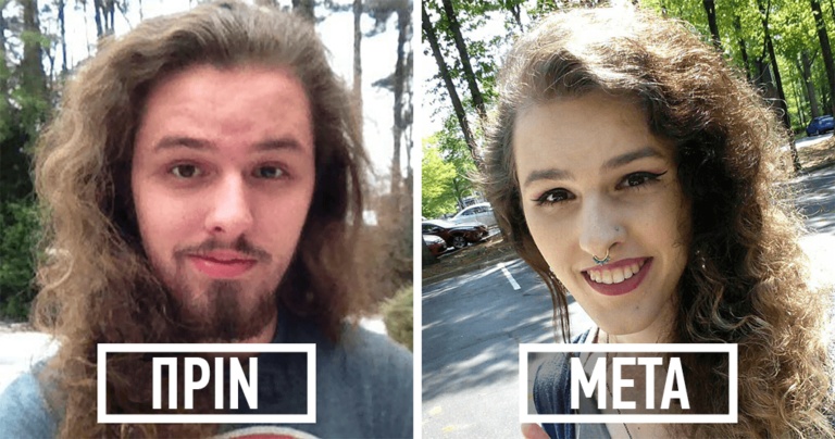 15 πριν και μετά φωτογραφίες ανθρώπων που έκαναν αλλαγή φύλου