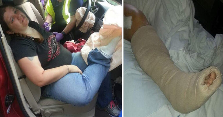 Μητέρα απέκτησε μόνιμη αναπηρία επειδή έβαλε το πόδι της στο ταμπλό του αυτικινήτου