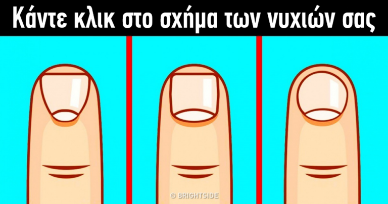 6 εκπληκτικά πράγματα που αποκαλύπτει το σχήμα των νυχιών ενός ανθρώπου