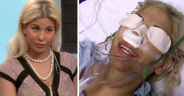 Γυναίκα έκανε 13 πλαστικές σε ένα χρόνο για να μοιάσει στην κόρη του Τραμπ