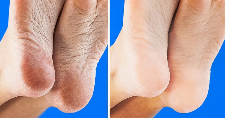 10 συνήθειες που θα αλλάξουν για τα καλά την ζωή σας προς το καλύτερο