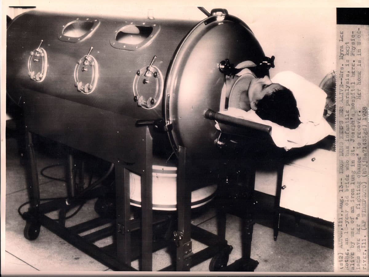 70 лет в железном легком. Iron lung Iron lung. Железное легкое аппарат полиомиелит. Iron lung 2022. Железные легкие аппарат.