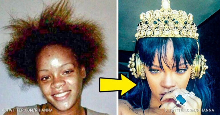 24 διάσημοι άνθρωποι που μεταμορφώθηκαν σε εξωφρενικό βαθμό