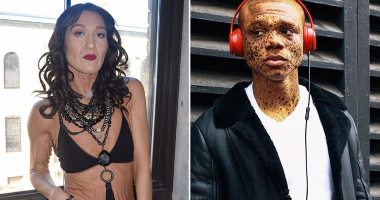 11 μοντέλα που δείχνουν πώς είναι να είσαι το αντίθετο του ιδανικού