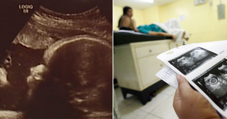 Ζευγάρι υποστηρίζει πως είδε τον Ιησού Χριστό σε υπερηχογράφημα