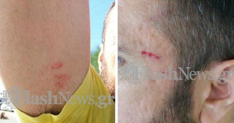 Κρήτη: Γυναίκα χτύπησε ΑμΕΑ μπροστά στα παιδιά του για θέση πάρκινγκ που του είχε πάρει