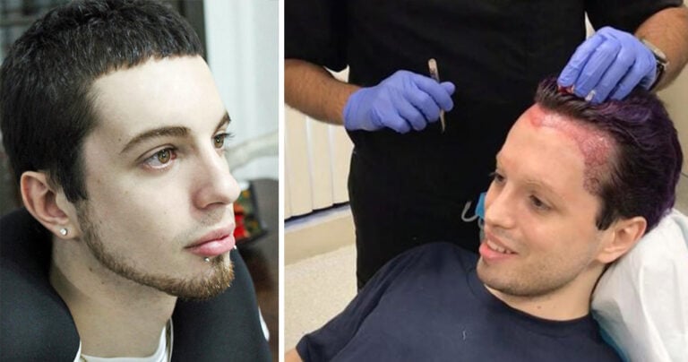 Φοιτητής ξόδεψε 40.000 ευρώ γιατί ήθελε να μοιάσει με ξωτικό