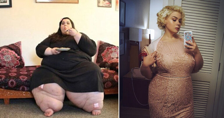 Η ιστορία της γυναίκας που ήταν 270 κιλά και έχασε 180 θα σας εμπνεύσει