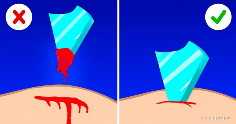 10 μύθοι πρώτων βοηθειών που μπορούν να βλάψουν σοβαρά την υγεία σας