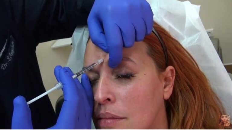 Η Σίσσυ Χρηστίδου κάνει μπότοξ και το δείχνει στην κάμερα