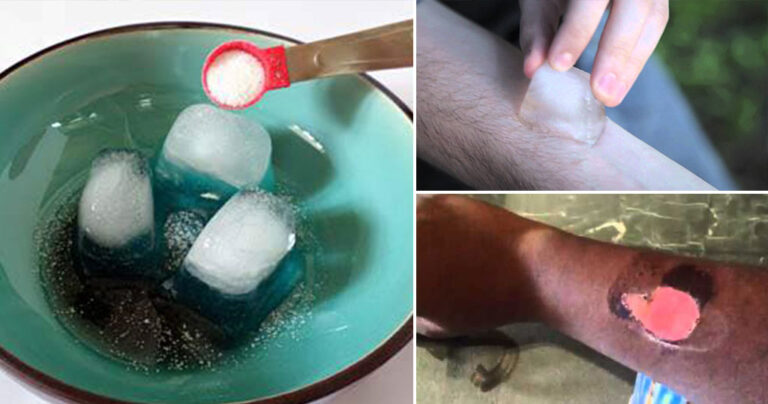 Μετά την «Μπλε Φάλαινα» τώρα έρχεται το «Salt and Ice Challenge» που προκαλεί εγκαύματα