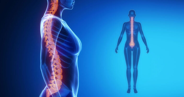 Μάθετε πώς να τεντώσετε τη σπονδυλική στήλη σας σε δύο λεπτά