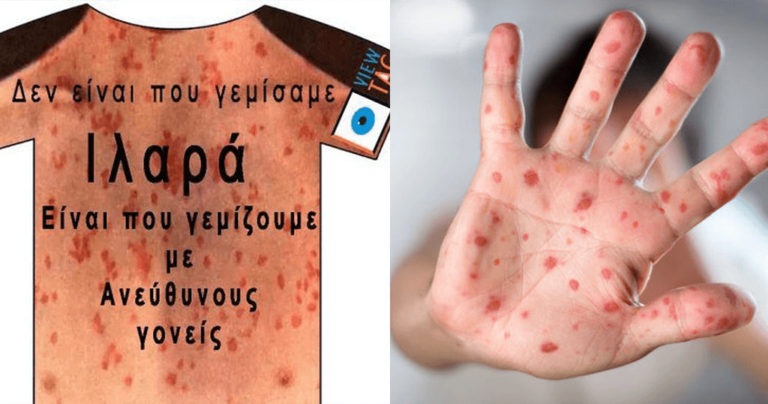 Δεν είναι η ιλαρά που σκοτώνει είναι η ηλιθιότητα. Κι αν πηγάζει από γονιό είναι ακόμα πιο επικίνδυνη