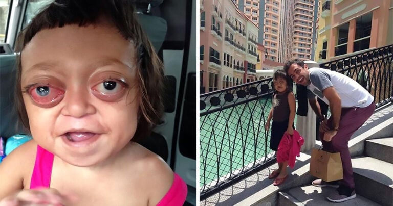 Μητέρα πούλησε το ανάπηρο κορίτσι της σε συμμορία για να ζητιανεύει μέχρι που το έσωσαν