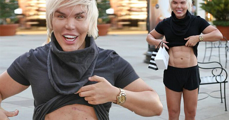 Ο άνθρωπος “Κεν κούκλα” δείχνει περήφανος τους ψεύτικους πλαστικούς κοιλιακούς του