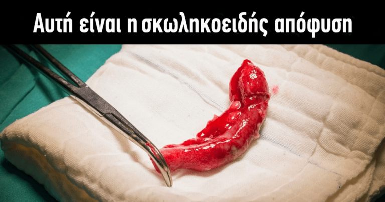 25 πολύ ασυνήθιστα πράγματα που δεν έχετε δει ξανά