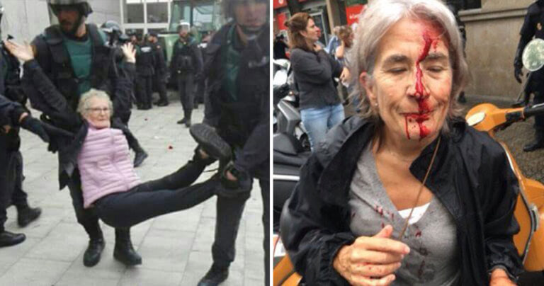 20 φωτογραφίες από σκηνές βίας στο δημοψήφισμα ανεξαρτησίας της Καταλονίας