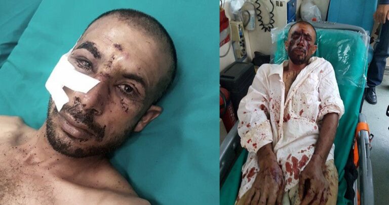 Mαρτυρίες των θυμάτων στον Ασπρόπυργο: «Έλεγαν ότι θα με κάψουν ζωντανό»