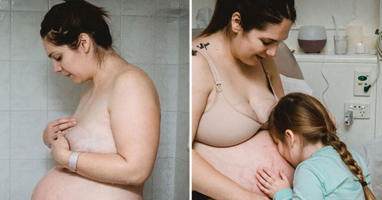 Έγκυος δείχνει το σώμα της όπως ακριβώς είναι λίγες ώρες αφότου έχει γεννήσει