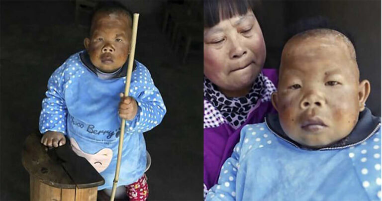 30χρονος από την Κίνα με ύψος 78 εκατοστά μοιάζει με μωρό