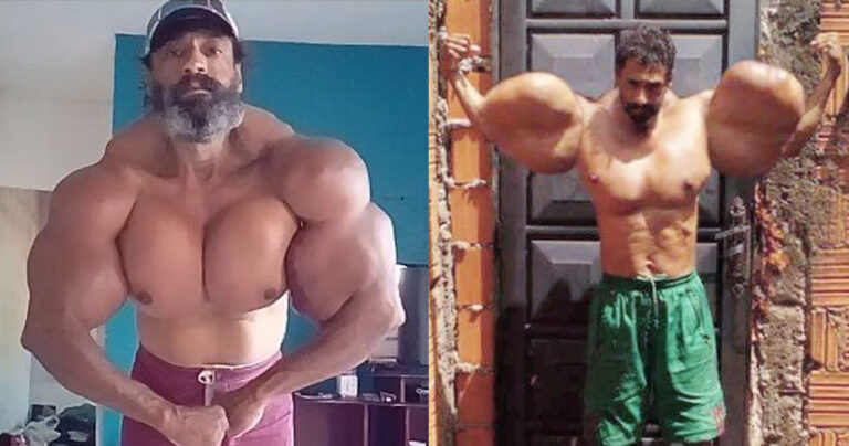 49χρονος κάνει ενέσεις με συνθετικό λάδι αυτοκινήτου για να φαίνεται γυμνασμένος