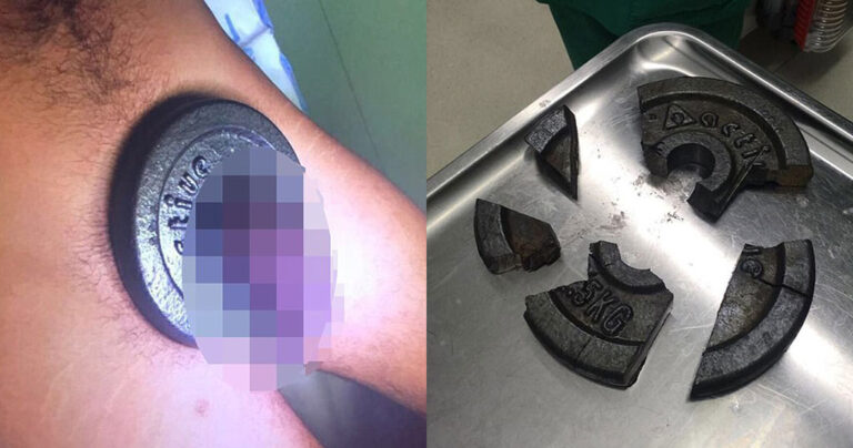 Γερμανός σφήνωσε το πέος του σε βαράκι και δεν μπορούσε να το ξεκολλήσει