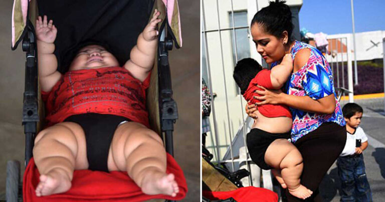Μητέρα με το παχύτερο μωρό στον κόσμο μιλάει για τα καθημερινά προβλήματά της