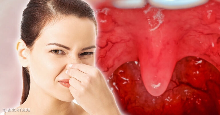 12 πράγματα που δεν πρέπει να κάνετε για να μην μυρίζει η αναπνοή σας