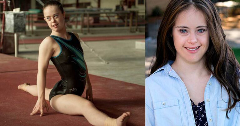 Η πρωταθλήτρια της γυμναστικής με σύνδρομο Down που έγινε και μανεκέν