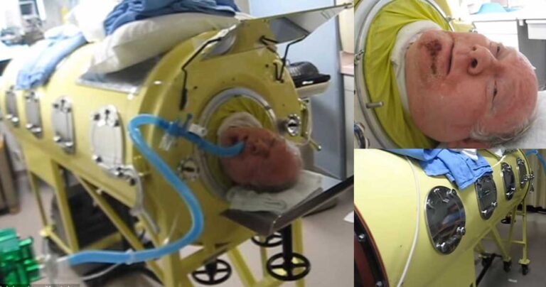 Άντρας που πάσχει πολιομυελίτιδα ζει εδώ και 65 χρόνια μέσα σε μηχανή