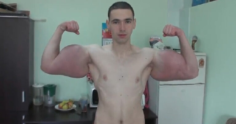 Από εδώ ο 21χρονος Ρώσος “Ποπάι” – Φούσκωσε με παυσίπονα και αλκοόλ