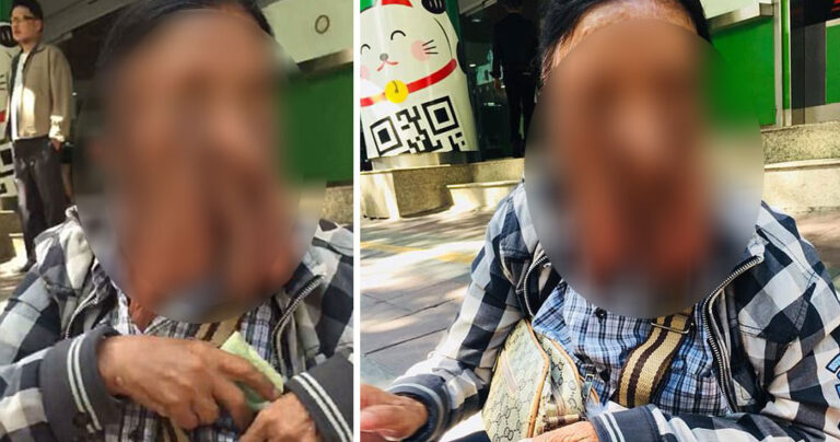 Γιαγιά που το πρόσωπό της λιώνει αρνείται να κάνει εγχείρηση για να μην πεθάνει