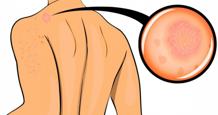 10 σημαντικά σημάδια ότι το σώμα σας είναι πολύ στρεσαρισμένο