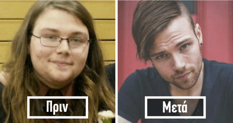 40 πριν και μετά φωτογραφίες που δείχνουν πώς το αδυνάτισμα αλλάζει το πρόσωπο
