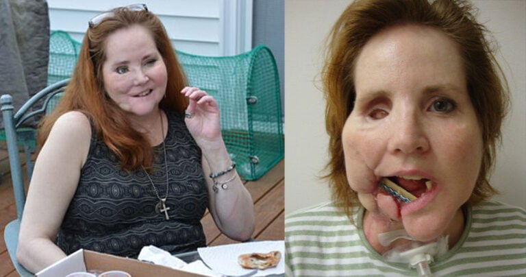 Γυναίκα που επιβίωσε από απόπειρα αυτοκτονίας με όπλο βρήκε την αγάπη