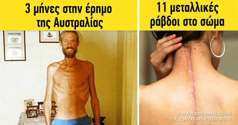 10 ανθρώπινες ιστορίες που αποδεικνύουν ότι η θέληση για ζωή είναι μεγαλύτερη από τις περιστάσεις