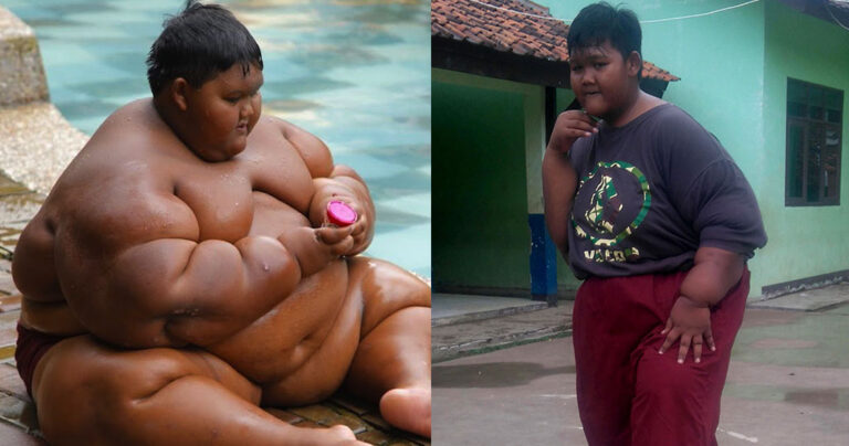 To πιο παχύσαρκο παιδί αδυνάτισε και πλέον μπορεί να παίζει με τους φίλους του