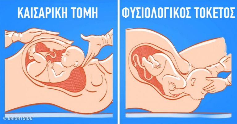 13 μύθοι για την εγκυμοσύνη που έχουν καταρριφθεί και θα βοηθήσουν τις μέλλουσες μητέρες