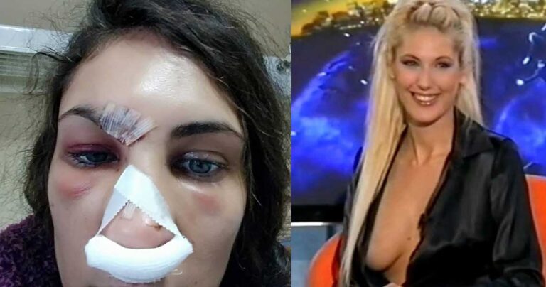 Σακατεμένο βρέθηκε το μοντέλο Ναστάζια Μητροπούλου