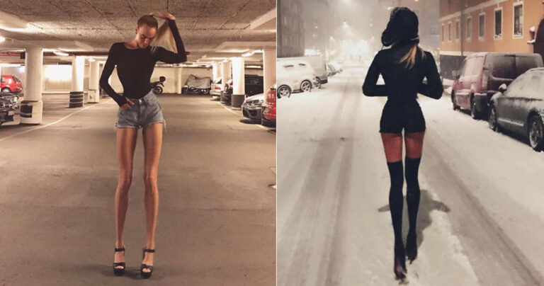 Σουηδέζα έχει τα πιο υπερφυσικά πόδια στον κόσμο με μήκος 102 εκατοστά